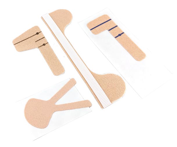 four samples of adhesive medical securements converted by Boyd