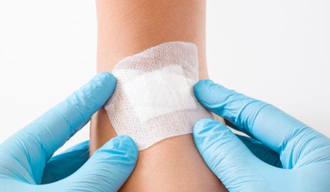 Advanced-Wound-Care